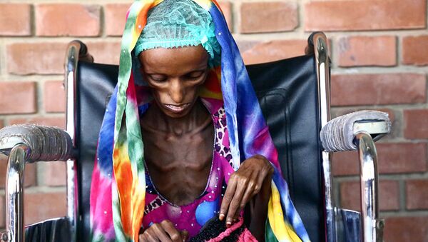 18-летняя пациентка больницы в Йемене, страдающая от истощения - Sputnik Ўзбекистон