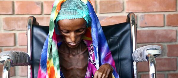 18-летняя пациентка больницы в Йемене, страдающая от истощения - Sputnik Ўзбекистон