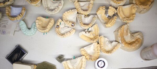 Слепки челюстей пациентов для изготовления металлокерамических протезов - Sputnik Узбекистан