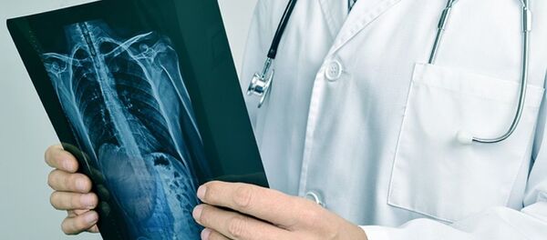 Врач держит рентгеновский снимок - Sputnik Ўзбекистон